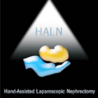 HALN – Nefrectomia laparoscopica “hand-assisted” - (Ed. 2001)