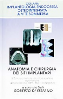 Anatomia e chirugia dei siti implantari - Zona anteriore, arcata superiore ed inferiore - Correlazione OPT – TC – Dentscan (Ed. 1996-97)