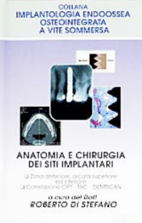Anatomia e chirugia dei siti implantari - Zona posteriore, arcata superiore ed inferiore - Correlazione OPT - TC - Dentscan (Ed. 1996-97)