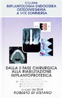 Dalla Seconda fase chirurgica alla riabilitazione implantoprotesica - (Ed. 1996-97)